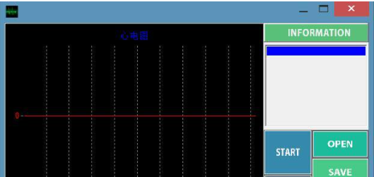 【E318】STM32實(shí)現(xiàn)的實(shí)時(shí)三導(dǎo)聯(lián)心電監(jiān)控系統(tǒng)