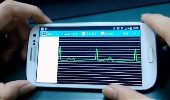 【E318】STM32實(shí)現(xiàn)的實(shí)時(shí)三導(dǎo)聯(lián)心電監(jiān)控系統(tǒng)