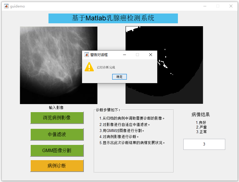 檢測(cè)結(jié)果.PNG