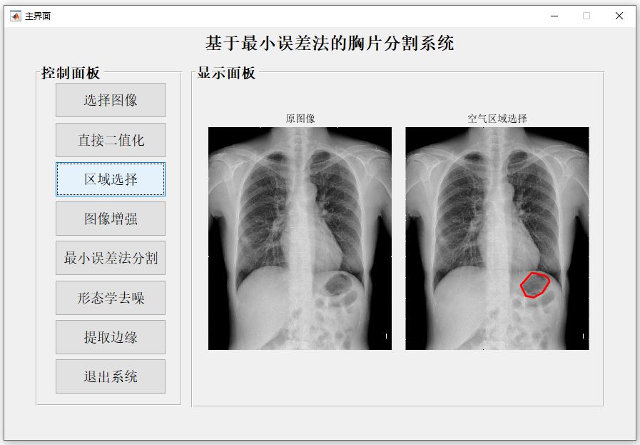 區(qū)域選擇.JPG