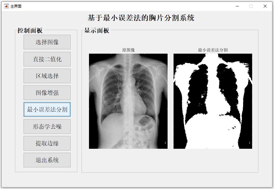 最小誤差法分割.JPG